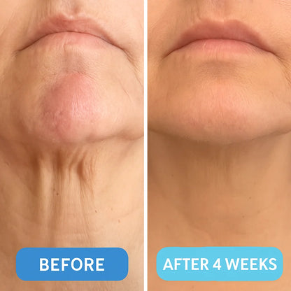 Botaniva Neck Firming Cream